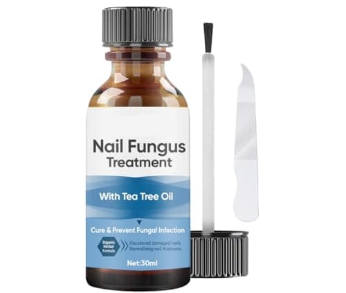 Micosi Unghie Piede, Rinforzante per Unghie, Antifungal, Ripara le Unghie in Modo Rapido ed Efficac, 30ML