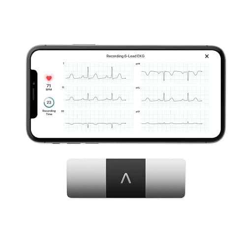 AliveCor KardiaMobile 6L ECG di livello medico | L’ECG Portatile a 6 Derivazioni | Rileva la Fibrillazione Atriale, Bradicardia e Tachicardia in Soli 30 Secondi | Distribuito da OMRON