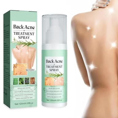 Torna soluzione brufolo, Spray per la rimozione dei brufoli sulla Schiena, Esfoliante schiena Pulizia profonda per corpo, petto e schiena, delicato sulla pelle Spray, 120 ml