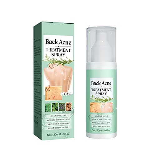HASAIKA® Torna soluzione brufolo, Esfoliante schiena Pulizia profonda per corpo, petto e schiena, delicato sulla pelle, 120 ml