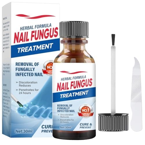 Antimicotico Unghie Piedi, Trattamento Efficace per Funghi e Infezioni alle Unghie dei Piedi, Rimuovere Funghi e Migliorare la Salute delle Unghie, Formula Naturale per Risultati Visibili-30ML