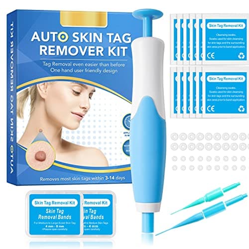 Rimozione Della Verruca Peduncolare Kit, 2 in 1 Auto Skin Tag Remover Elimina Fibromi Penduli 2-8 mm, Penna per Rimozione Delle Etichette Della Pelle - Sicuro e indolore (Blu)